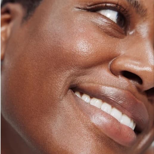 Progressive Chemical Peels (3) at Spa Ravine Med Aesthetics in wayne, NJ